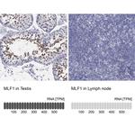 MLF1 Polyclonal Antibody