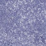 MLF1 Antibody in Immunohistochemistry (Paraffin) (IHC (P))