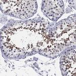 MLF1 Antibody in Immunohistochemistry (Paraffin) (IHC (P))