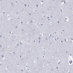 DDI1 Antibody in Immunohistochemistry (Paraffin) (IHC (P))