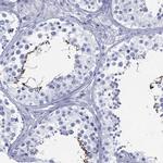 DDI1 Antibody in Immunohistochemistry (Paraffin) (IHC (P))