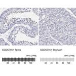 CCDC70 Polyclonal Antibody
