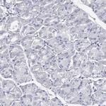 CCDC70 Antibody in Immunohistochemistry (Paraffin) (IHC (P))