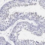 CCDC70 Antibody in Immunohistochemistry (Paraffin) (IHC (P))