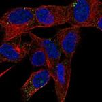 PRSS27 Polyclonal Antibody