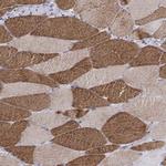 ESGP Antibody in Immunohistochemistry (Paraffin) (IHC (P))
