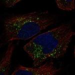 TRAPPC3L Polyclonal Antibody