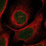 BTBD11 Polyclonal Antibody