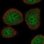 ATAD5 Polyclonal Antibody