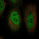 TRIM49D1 Polyclonal Antibody