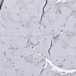Septin 1 Antibody in Immunohistochemistry (Paraffin) (IHC (P))