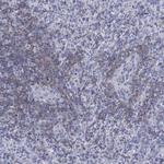 Septin 1 Antibody in Immunohistochemistry (Paraffin) (IHC (P))
