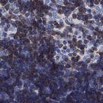 Septin 1 Antibody in Immunohistochemistry (Paraffin) (IHC (P))