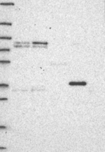 MT-CYB Antibody in Western Blot (WB)