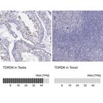 TDRD6 Polyclonal Antibody