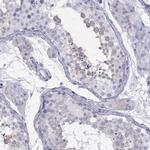 TDRD6 Antibody in Immunohistochemistry (Paraffin) (IHC (P))