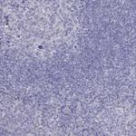 TDRD6 Antibody in Immunohistochemistry (Paraffin) (IHC (P))