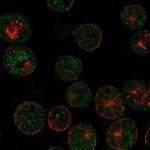 MAGEB16 Polyclonal Antibody