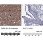 SLC4A10 Antibody in Immunohistochemistry (Paraffin) (IHC (P))