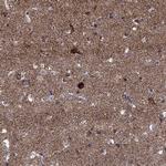 SLC4A10 Antibody in Immunohistochemistry (Paraffin) (IHC (P))