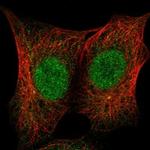 ZNF206 Polyclonal Antibody