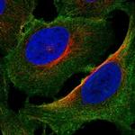 PALM2-AKAP2 Antibody in Immunocytochemistry (ICC/IF)