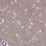 LY6H Antibody in Immunohistochemistry (Paraffin) (IHC (P))