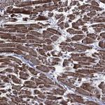 HTD2 Polyclonal Antibody