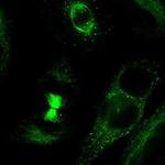 TDRD6 Polyclonal Antibody