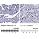KIAA2012 Polyclonal Antibody