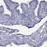 KIAA2012 Antibody in Immunohistochemistry (Paraffin) (IHC (P))
