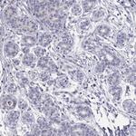C8orf88 Antibody in Immunohistochemistry (Paraffin) (IHC (P))