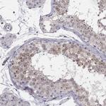 C8orf88 Antibody in Immunohistochemistry (Paraffin) (IHC (P))