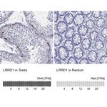 LRRD1 Polyclonal Antibody