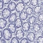 LRRD1 Antibody in Immunohistochemistry (Paraffin) (IHC (P))