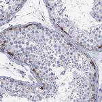 LRRD1 Antibody in Immunohistochemistry (Paraffin) (IHC (P))