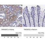 TMEM252 Polyclonal Antibody