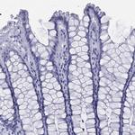 TMEM252 Antibody in Immunohistochemistry (Paraffin) (IHC (P))
