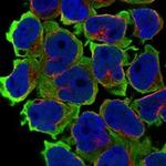 LSMEM2 Polyclonal Antibody