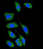 DAPK1 Antibody in Immunocytochemistry (ICC/IF)