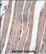 DAPK1 Antibody in Immunohistochemistry (Paraffin) (IHC (P))