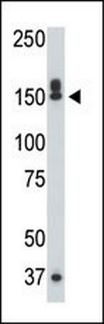 DAPK1 Antibody in Western Blot (WB)
