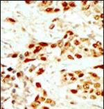 DAPK2 Polyclonal Antibody