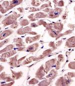 SPHK1 Polyclonal Antibody