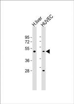 SPHK1 Antibody in Western Blot (WB)