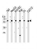 SPHK1 Antibody in Western Blot (WB)