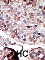SPHK2 Polyclonal Antibody