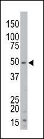 STK35 Antibody in Western Blot (WB)