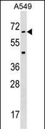 STK35 Antibody in Western Blot (WB)