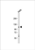 CDKL5 Antibody in Western Blot (WB)